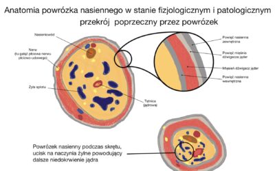 Skręt i amputacja męskości